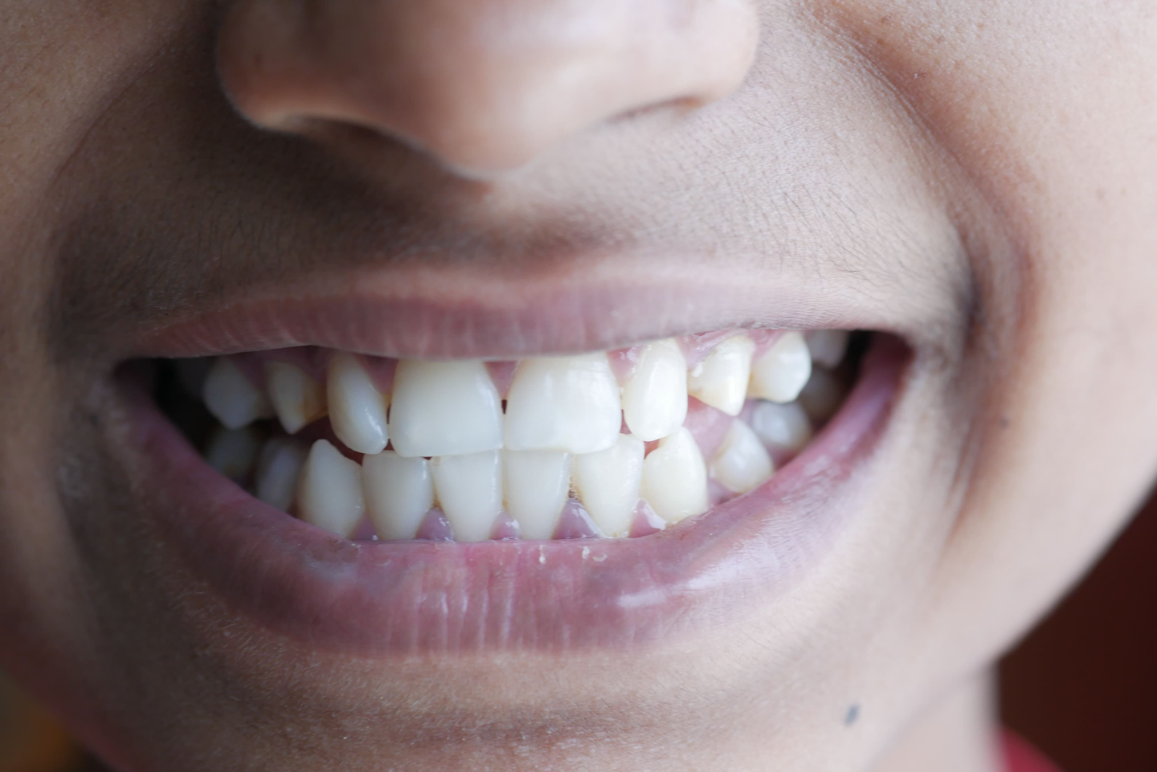 10 Essential Tips for Optimal Teeth Health